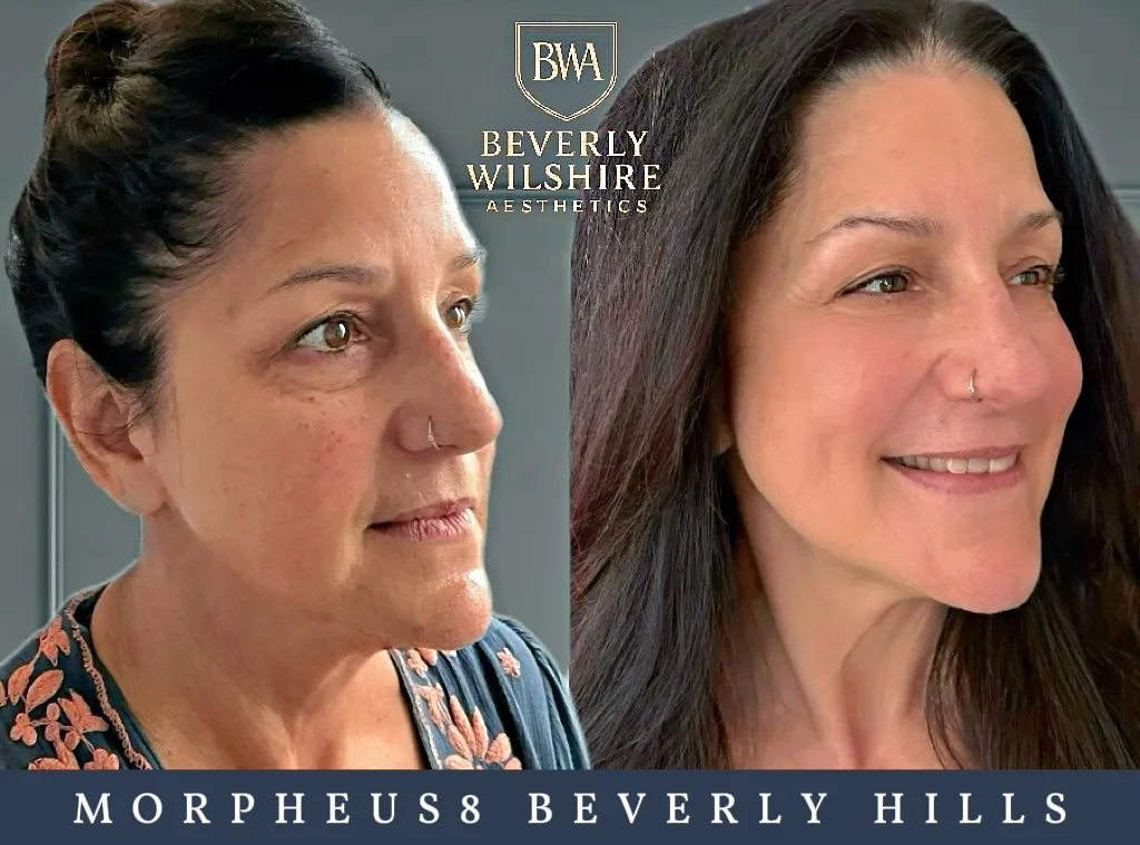 Beverly Wilshire Aesthetics Beverly Hills Medical Spa image 5