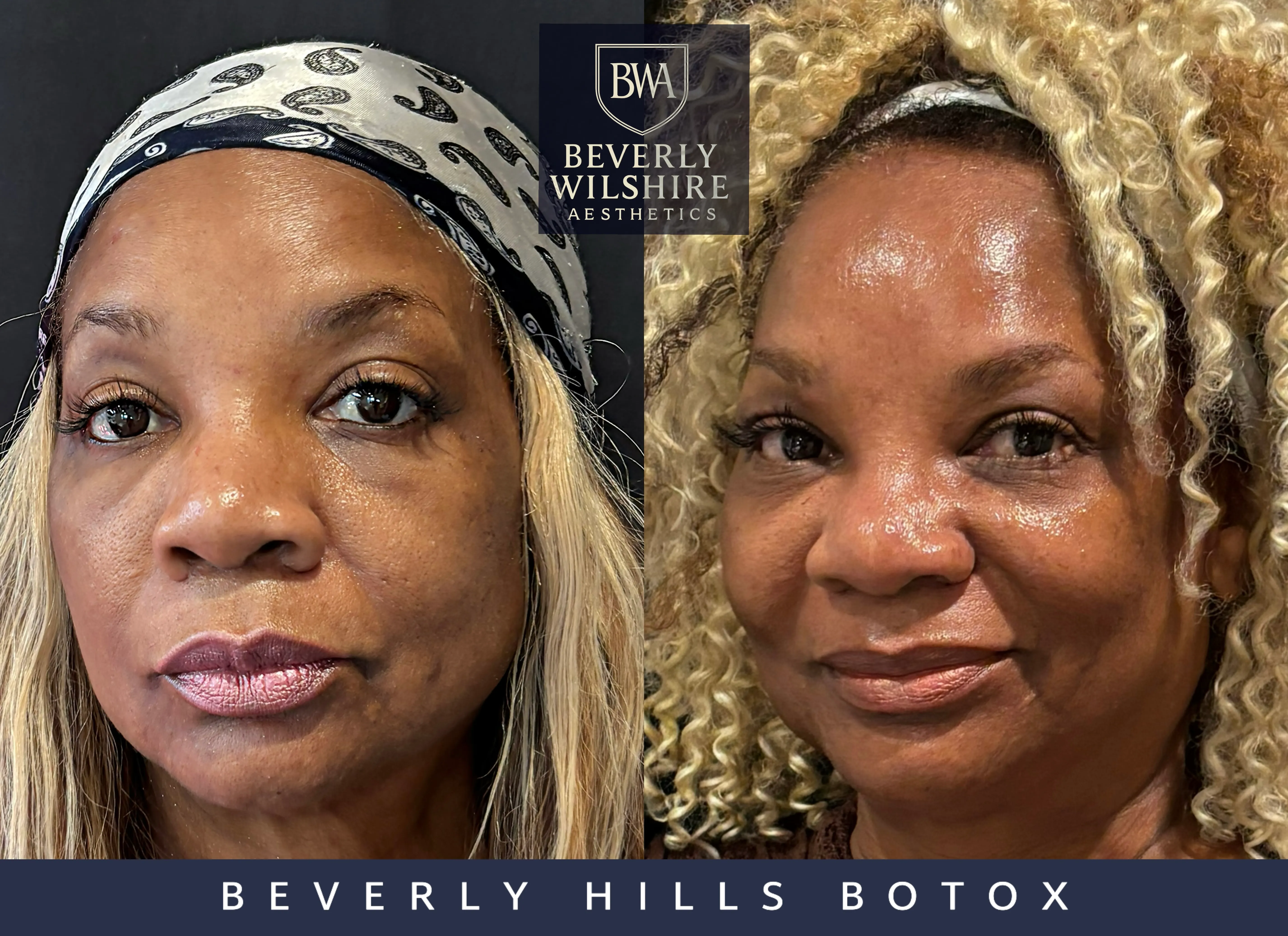 Beverly Wilshire Aesthetics Beverly Hills Medical Spa image 4
