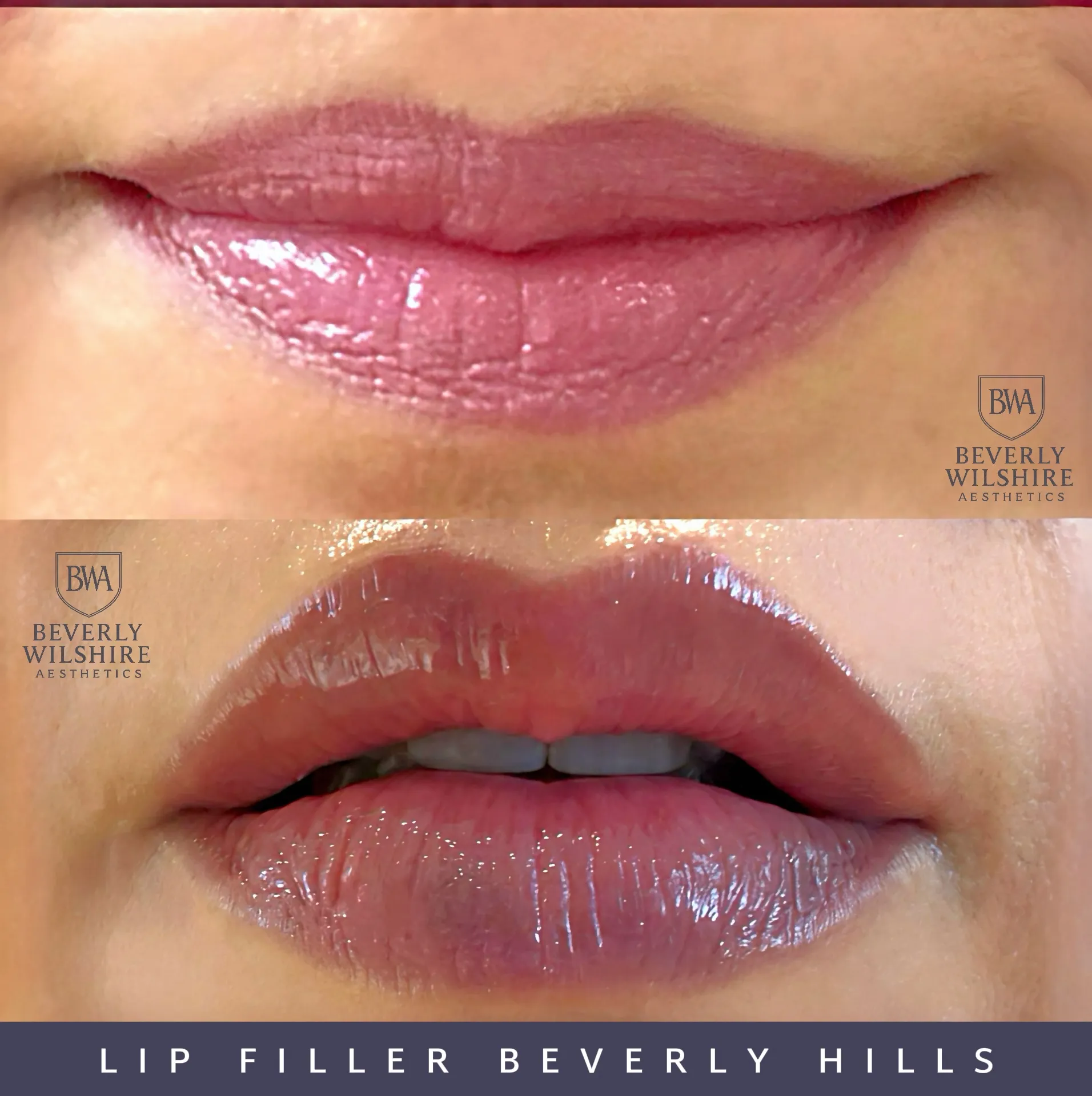 Beverly Wilshire Aesthetics Beverly Hills Medical Spa image 6