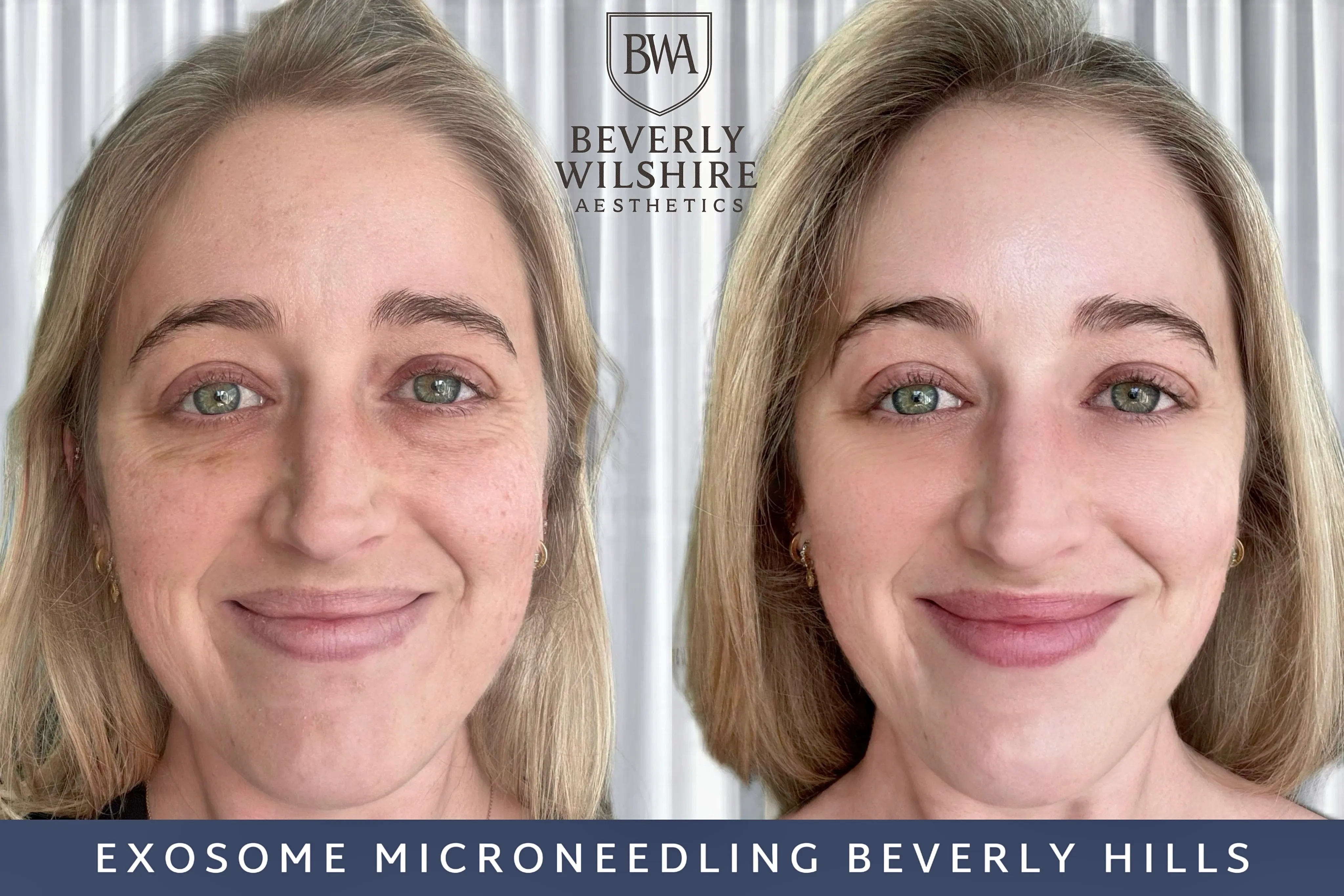 Beverly Wilshire Aesthetics Beverly Hills Medical Spa image 2