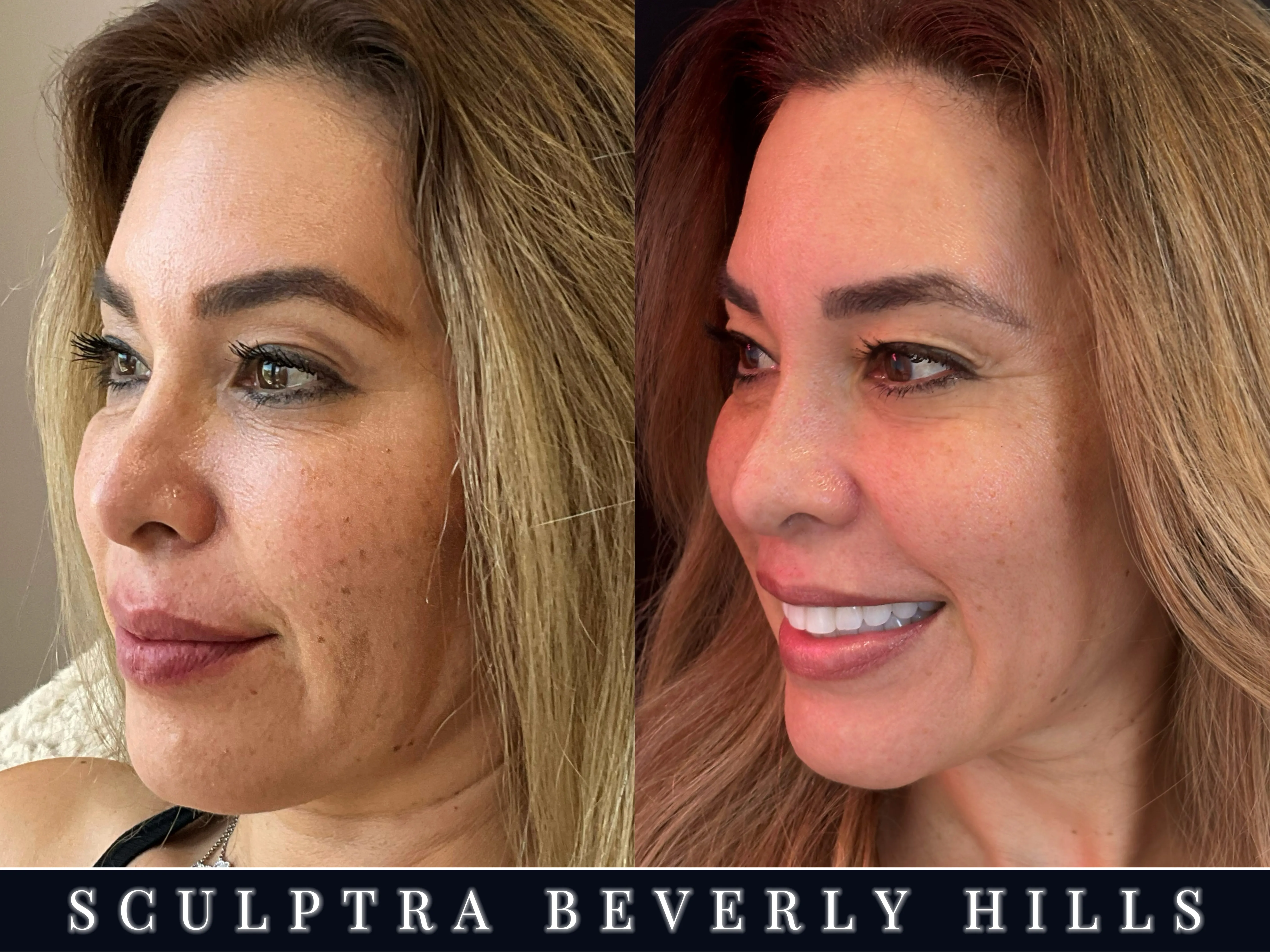 Beverly Wilshire Aesthetics Beverly Hills Medical Spa image 8