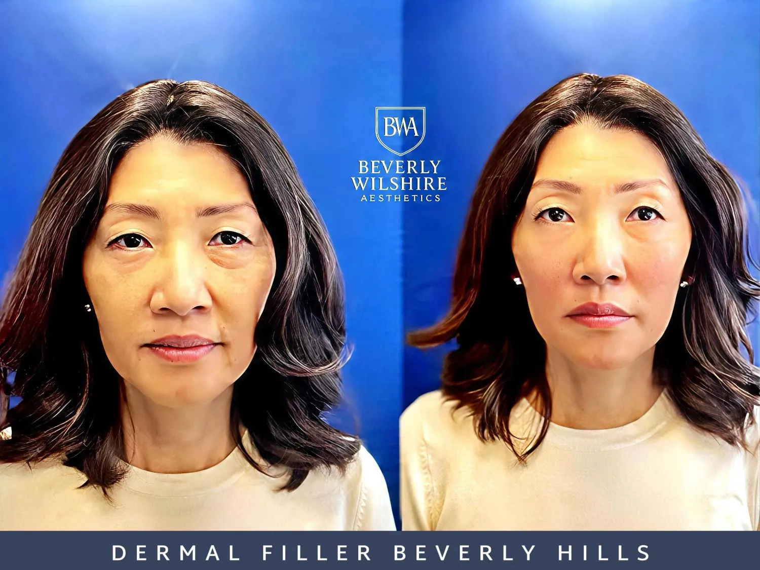 Beverly Wilshire Aesthetics Beverly Hills Medical Spa image 9