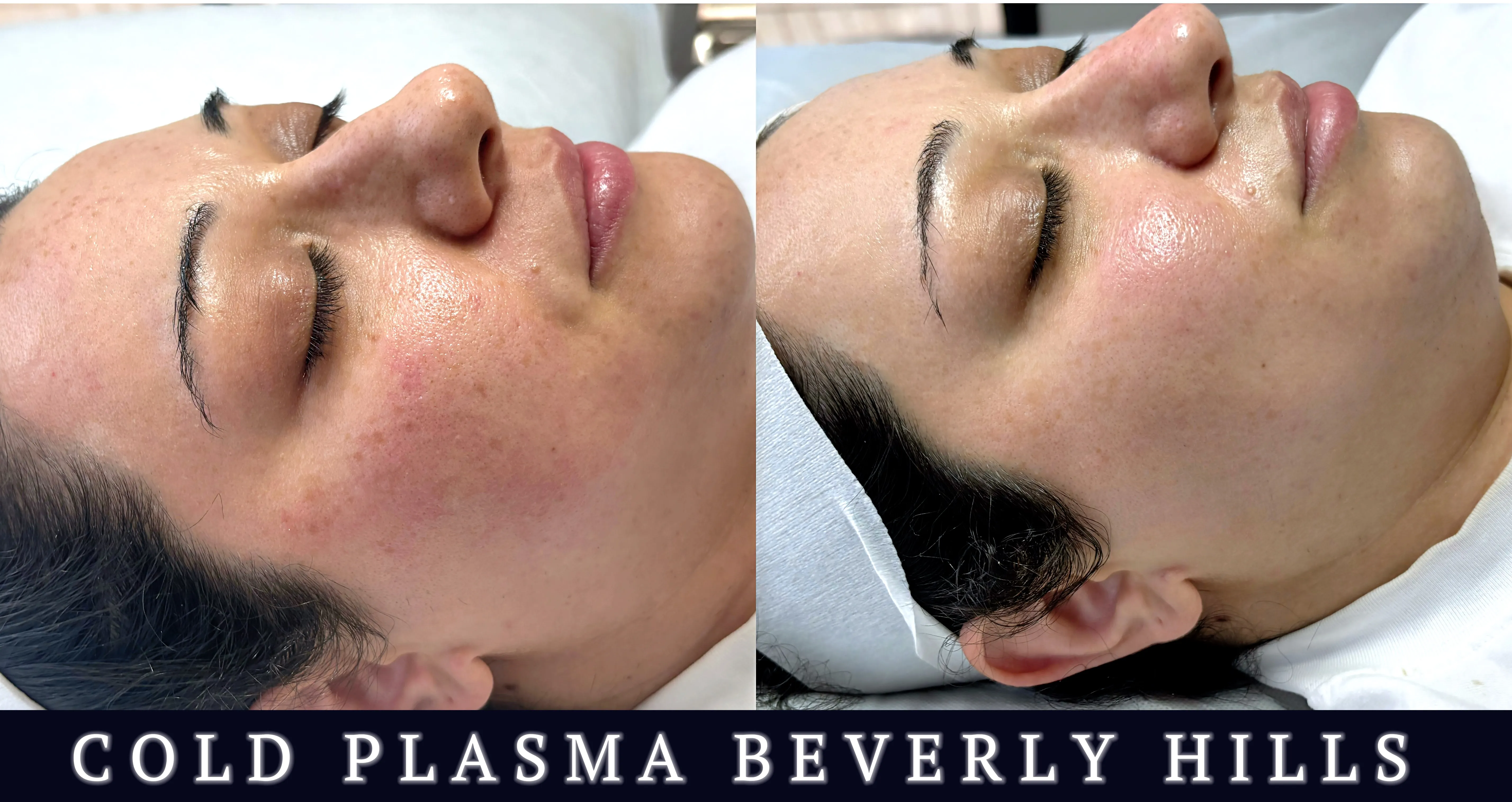 Beverly Wilshire Aesthetics Beverly Hills Medical Spa image 10