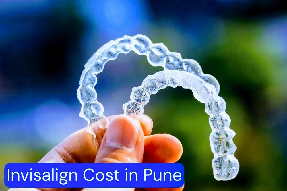 Dr.Mathesul Invisalign Orthodontist Braces & Dental Implant Clinic image 10